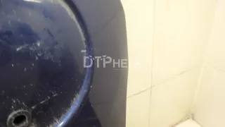 41617153940 Капот BMW 3 E90/E91/E92/E93 Арт AM95214300, вид 11