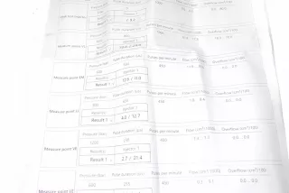 7793836 Форсунка BMW 3 E46 Арт AL17662500091, вид 4